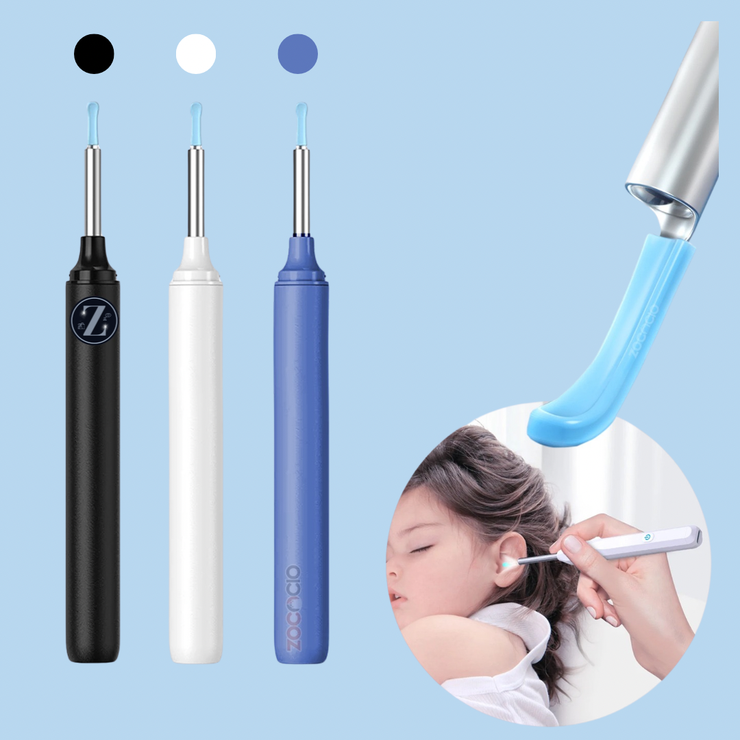👂✨ Limpiador de oídos con cámara endoscopio HD - Limpieza segura y tecnología de precisión 🌟
