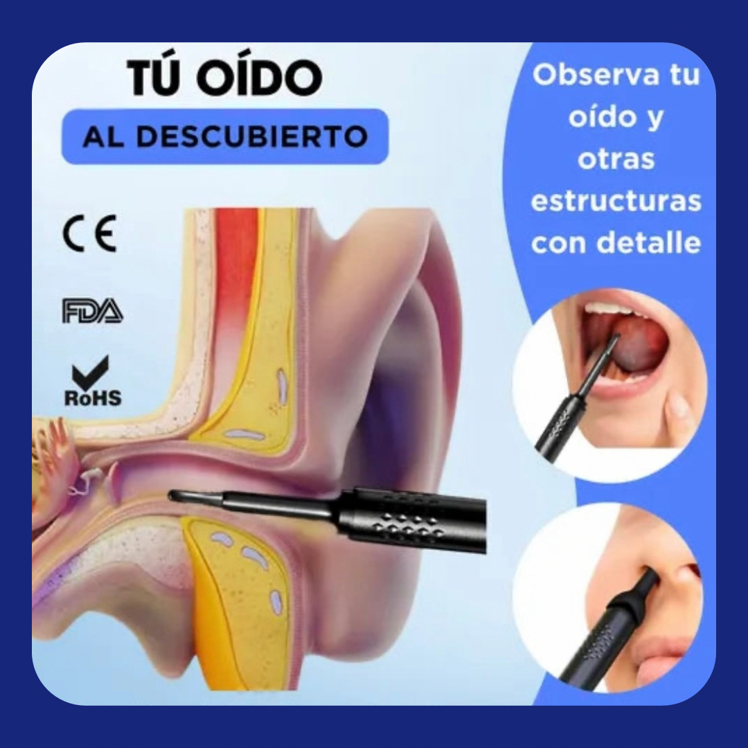 👂✨ Limpiador de oídos con cámara endoscopio HD - Limpieza segura y tecnología de precisión 🌟